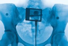 Lorde reneix a “Virgin”