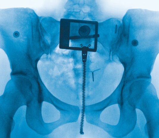 Lorde reneix a “Virgin”